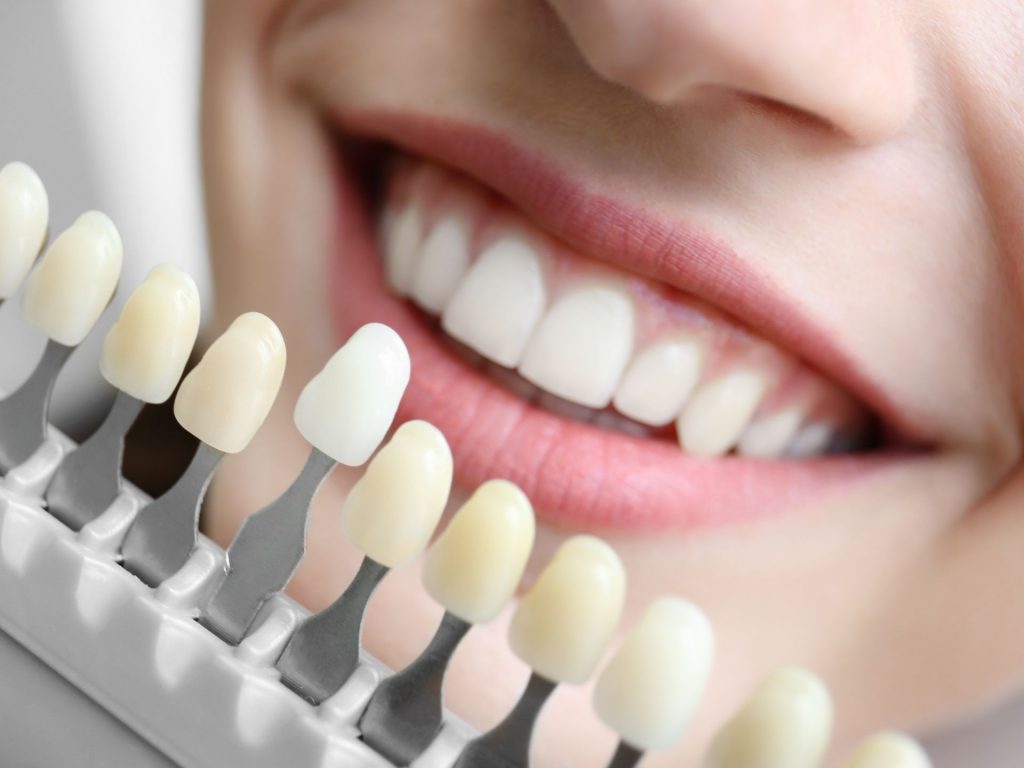 estetica-dental-clinica-dental-smile-2